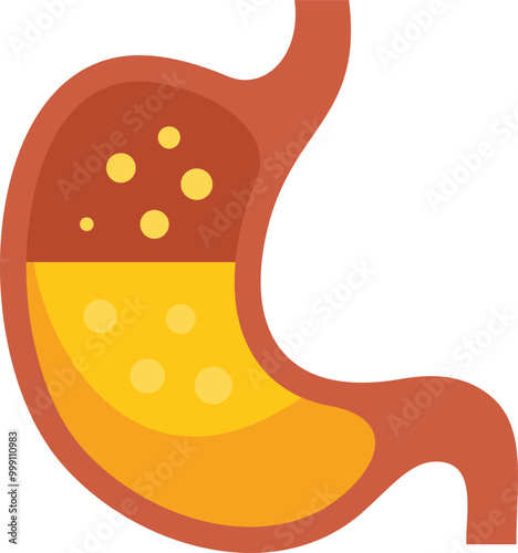 Illustration of a human stomach showing gastritis with acid coming up the esophagus
