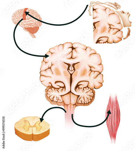 Extrapyramidal symptoms 