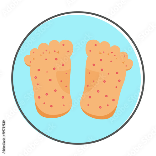 hand foot and mouth Disease symptoms. vector illustration photo