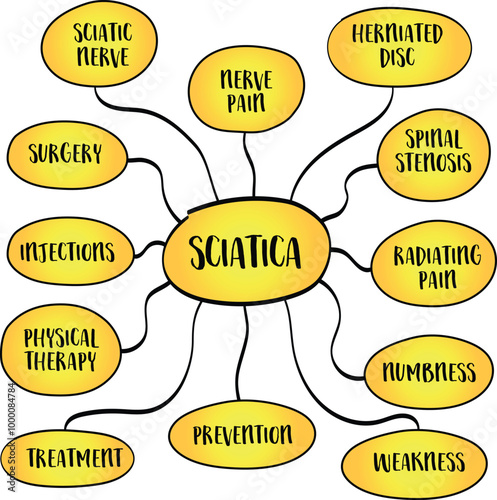 Sciatica refers to pain that radiates along the path of the sciatic nerve, the largest nerve in the body, vector mind map infographics.
