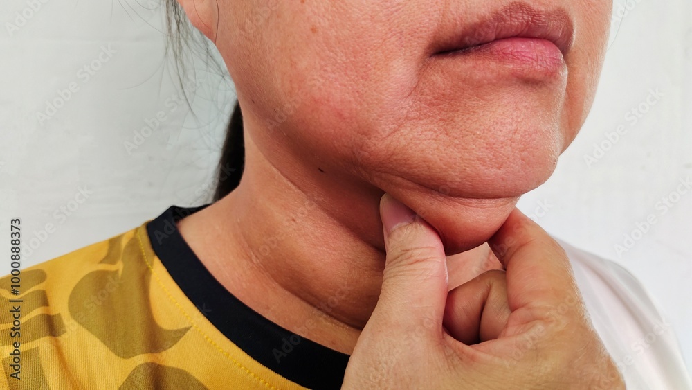 Fototapeta premium portrait the fingers squeezing the flabbiness adipose sagging skin under the chin, neck wattle and cellulite under the neck, Flabby and scar on the body of the woman, health care and beauty concept.