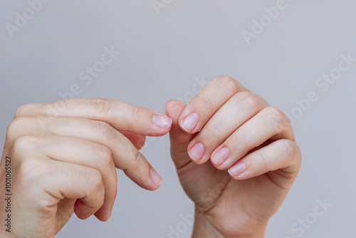 Young woman's hand pointing to the burr on the finger near the nail on a grey background. Agnail, hangnail, cuticles