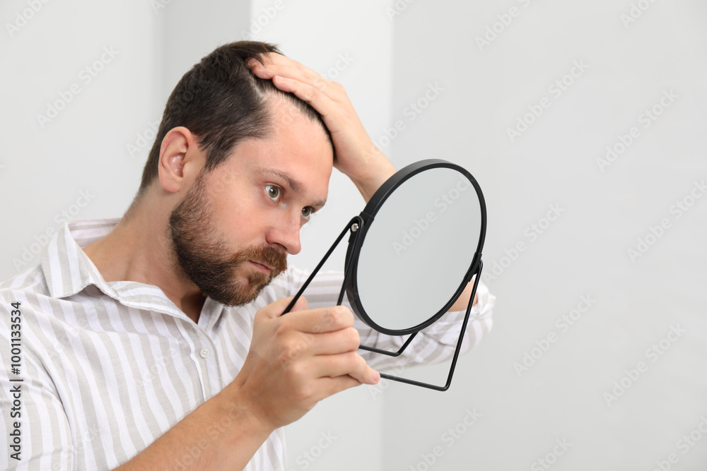 Man with hair loss problem looking at mirror indoors Man with hair loss problem looking at mirror indoors