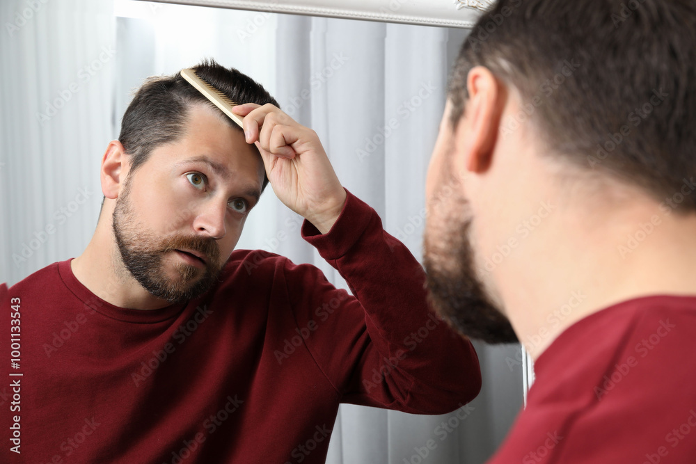 Fototapeta premium Man brushing his hair near mirror indoors. Alopecia problem