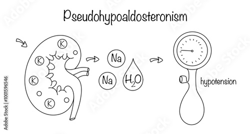 Pseudohypoaldosteronism