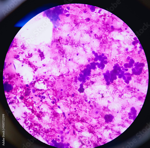 Konstfotografi Ovarian cyst, light micrograph, the photo under the microscope.