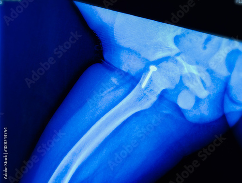 Fotografie X-ray of both legs, thigh view