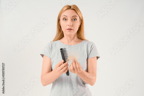 Mature woman with hair loss...