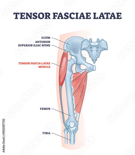 An anatomical diagram showing the Tensor Fasciae Latae muscle and its location on the hip and thigh, highlighting key skeletal structures, diagram, transparent background.
