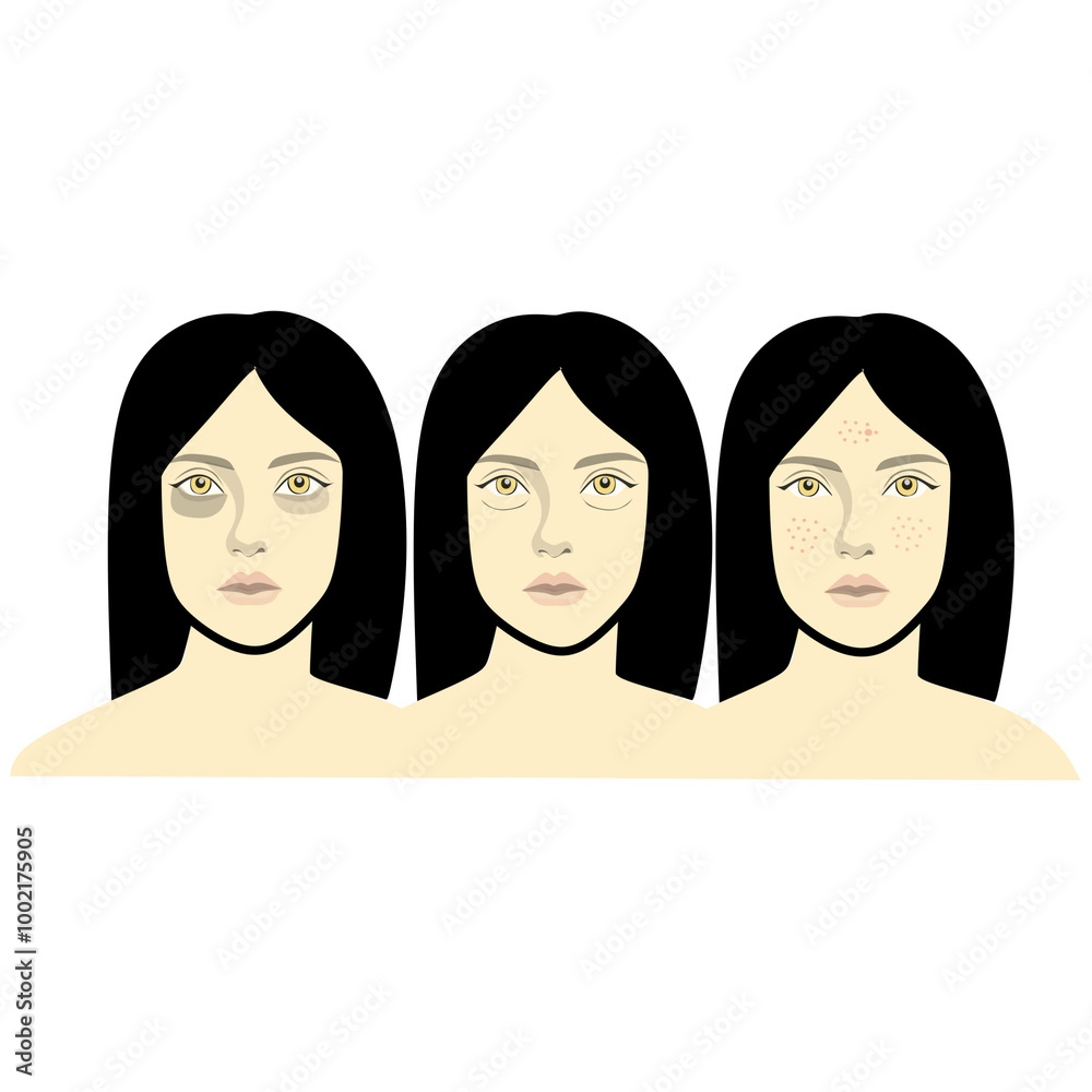 various beauty problems vector illustration consisting of dark black eyes, eye bags and acne-prone face various beauty problems vector illustration consisting of dark black eyes, eye bags and acne-prone face