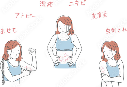 肌荒れした女性のイラストセット