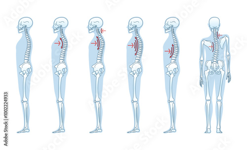 Understanding the Different Types of Standing Posture for Achieving Better Health and Wellness