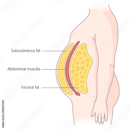 layers of subcutaneous and visceral fat in the human abdomen, abdominal muscles and fat distribution diagram hand drawn schematic raster illustration. Medical science educational illustration
