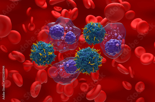 CAR T cell therapy in Multiple myeloma (MM) - isometric view 3d illustration
