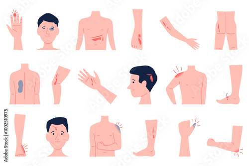 Physical injury. Human body parts with various wounds injury bruise. Physical traumas on head hand legs or face, bones fractures and cut, recent vector set