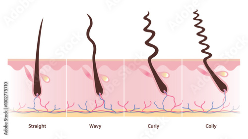 Hair types with follicles vector illustration isolated on white background. Cross section of straight, wavy, curly, kinky and coily hair with scalp layer. Types of hair set. Hair anatomy concept.