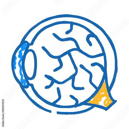 inflammation of eye ophthalmology doodle icon sketch vector. inflammation of eye ophthalmology sign. isolated symbol illustration