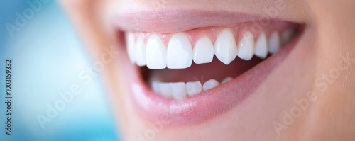 A patient's mouth shown before dental implants, with several missing teeth, and after surgery with a complete set of natural-looking, secure implants. photo