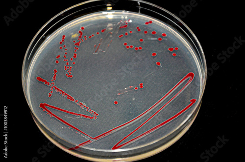 Petri dish with red colony of bacteria