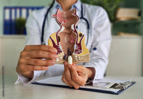 Doctor opens anal medical suppositories for digestive problems concept photo