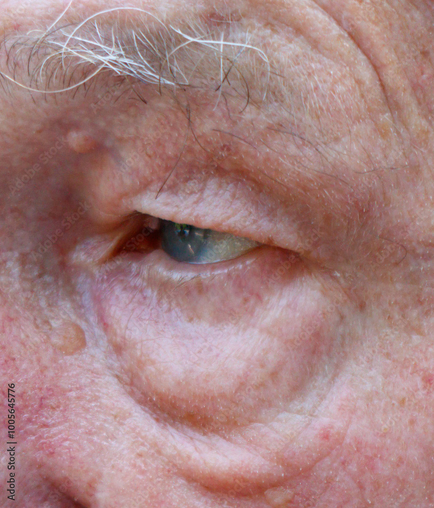 A man with a wrinkled face and a blue eye A man with a wrinkled face and a blue eye