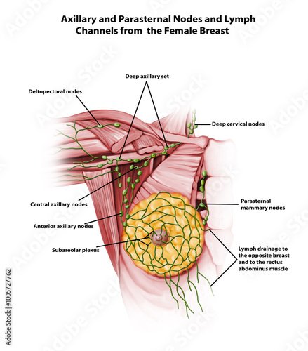 Axillary and Parasternal Nodes and Lymph Channels from  the Female Breast