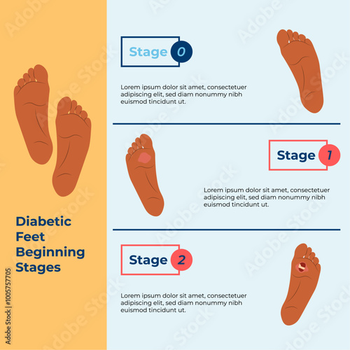 world diabetes day awareness infographic feet condition stages flat illustration