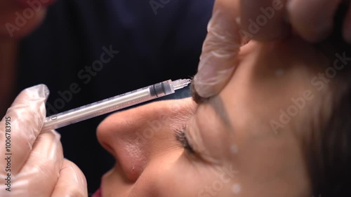 Beautician doctor makes botulinum toxin injection in the forehead of young beautiful woman. Close up 4k vertical shot photo