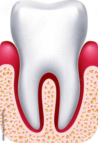 Gingivitis illustration. Gum disease. Dental treatment drawing