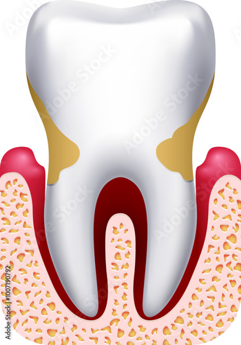 Periodontal disease. Tooth pain. Dental infection drawing