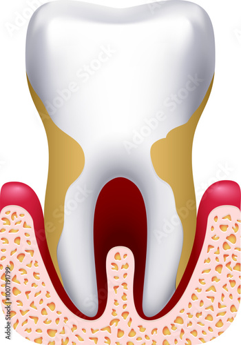 Periodontitis drawing. Dental clinic treatment. Tooth disease