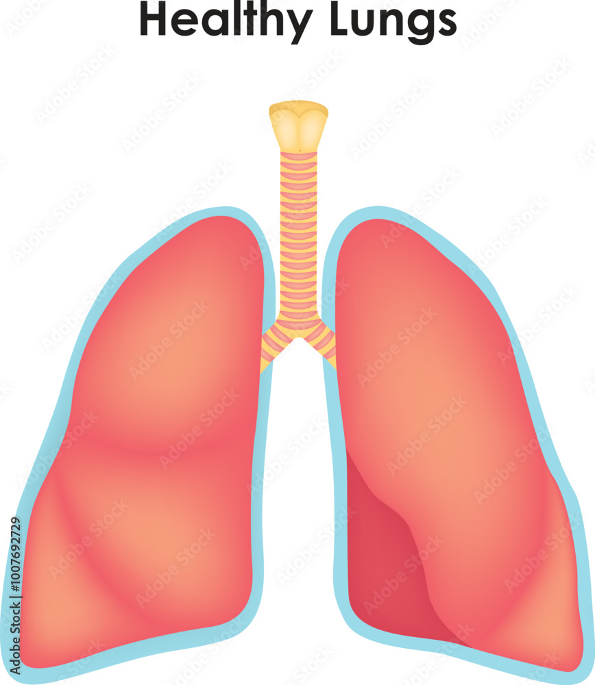 Lungs Tumor Trachea Superior Lobe Bronchi Tumor Inferior Lobe Middle Lobe Left And Right Lobe Science Vector Illustration Lungs Tumor Trachea Superior Lobe Bronchi Tumor Inferior Lobe Middle Lobe Left And Right Lobe Science Vector Illustration