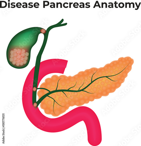 Disease Pancreas Anatomy Science Vector Illustration