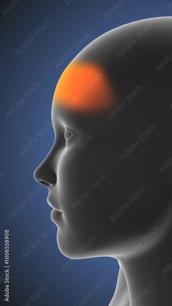 Medical concept of head ache Medical concept of head ache