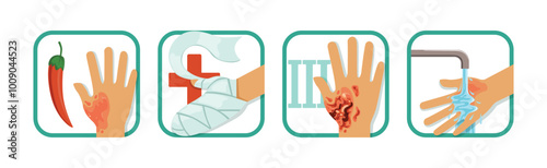 Hand Burn Degree and First Aid Procedure Vector Set