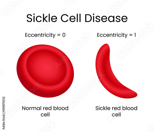 Sickle Cell Disease Clinical Science