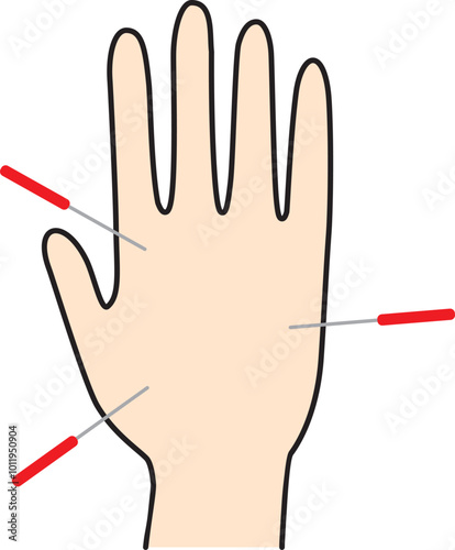 Acupuncture needles on Hand Healing icon.