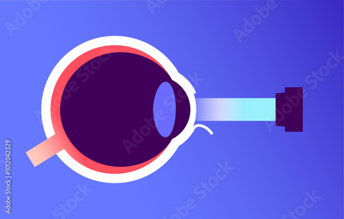 Lasik eye surgery
