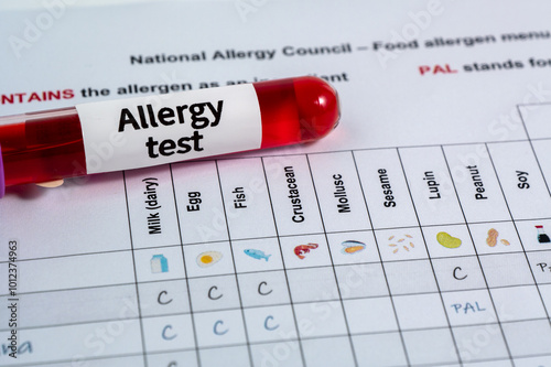 Test tube with blood sample for food allergy test