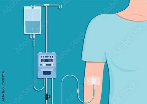 Intravenous therapy or IV therapy is a medical technique.