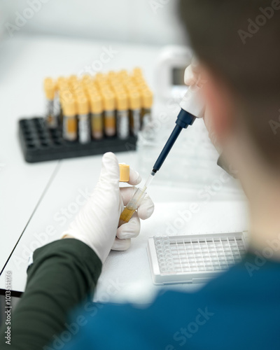 Fotografie Gloved laboratory technician performs clinical tests in medical laboratory