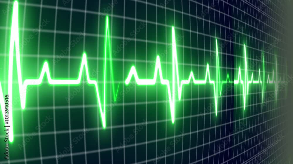 EKG ECG flatline. Heart beat line on monitor of electrocardiogram machine in extreme close-up, seamless loop EKG ECG flatline. Heart beat line on monitor of electrocardiogram machine in extreme close-up, seamless loop