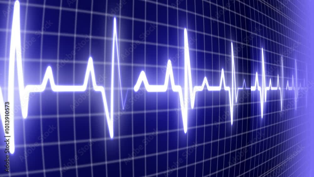 EKG ECG flatline. Heart beat line on monitor of electrocardiogram machine in extreme close-up, seamless loop EKG ECG flatline. Heart beat line on monitor of electrocardiogram machine in extreme close-up, seamless loop