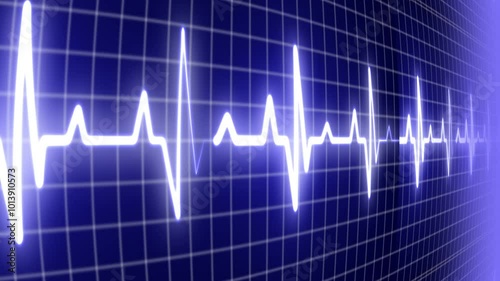 EKG ECG flatline. Heart beat line on monitor of electrocardiogram machine in extreme close-up, seamless loop
