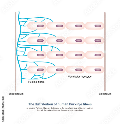 In humans, Purkinje fibers are not distributed throughout the entire ventricular wall, but rather in the superficial myocardium beneath the endocardium and do not reach the epicardium. photo