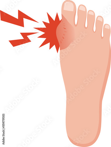 足の痛みと腫れのイラスト