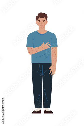man with monkeypox outbreak infectious disease