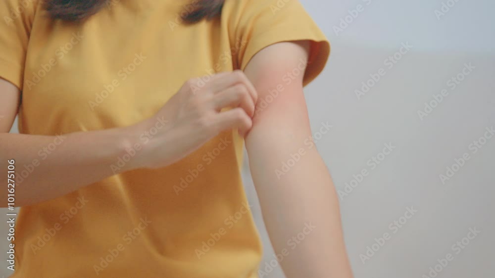 Scratching Reaction woman itching and scratching itchy arm. Sensitive Skin Allergic ...