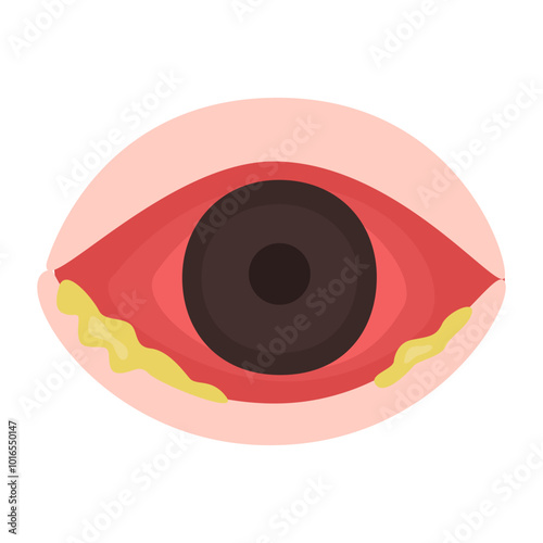 conjunctivitis eyes allergy infection disease