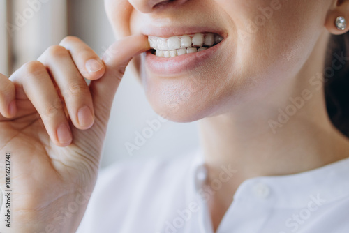Close-Up Of A Woman Wearing Invisible Orthodontics And Touching Them With Her Finger. Dental Health Medical Care Concept.